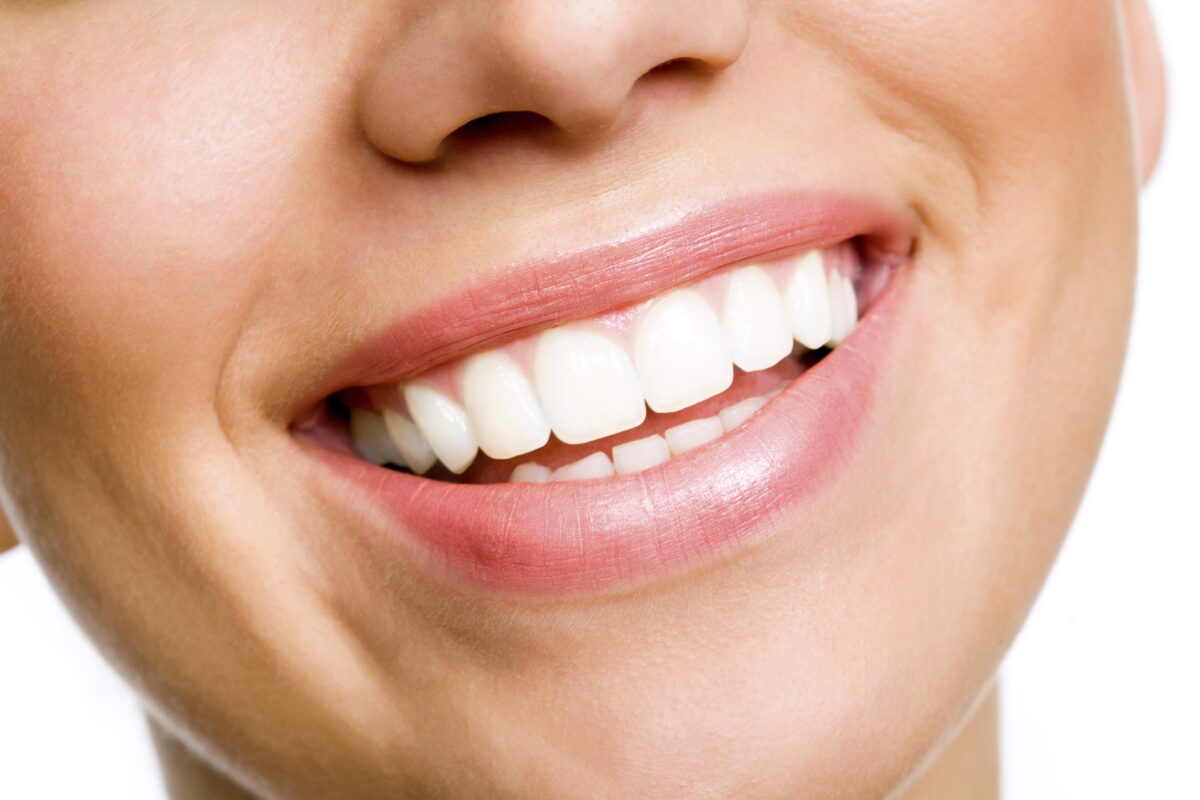 Feel Radiant with Smart Teeth Whitening Cost in Dubai