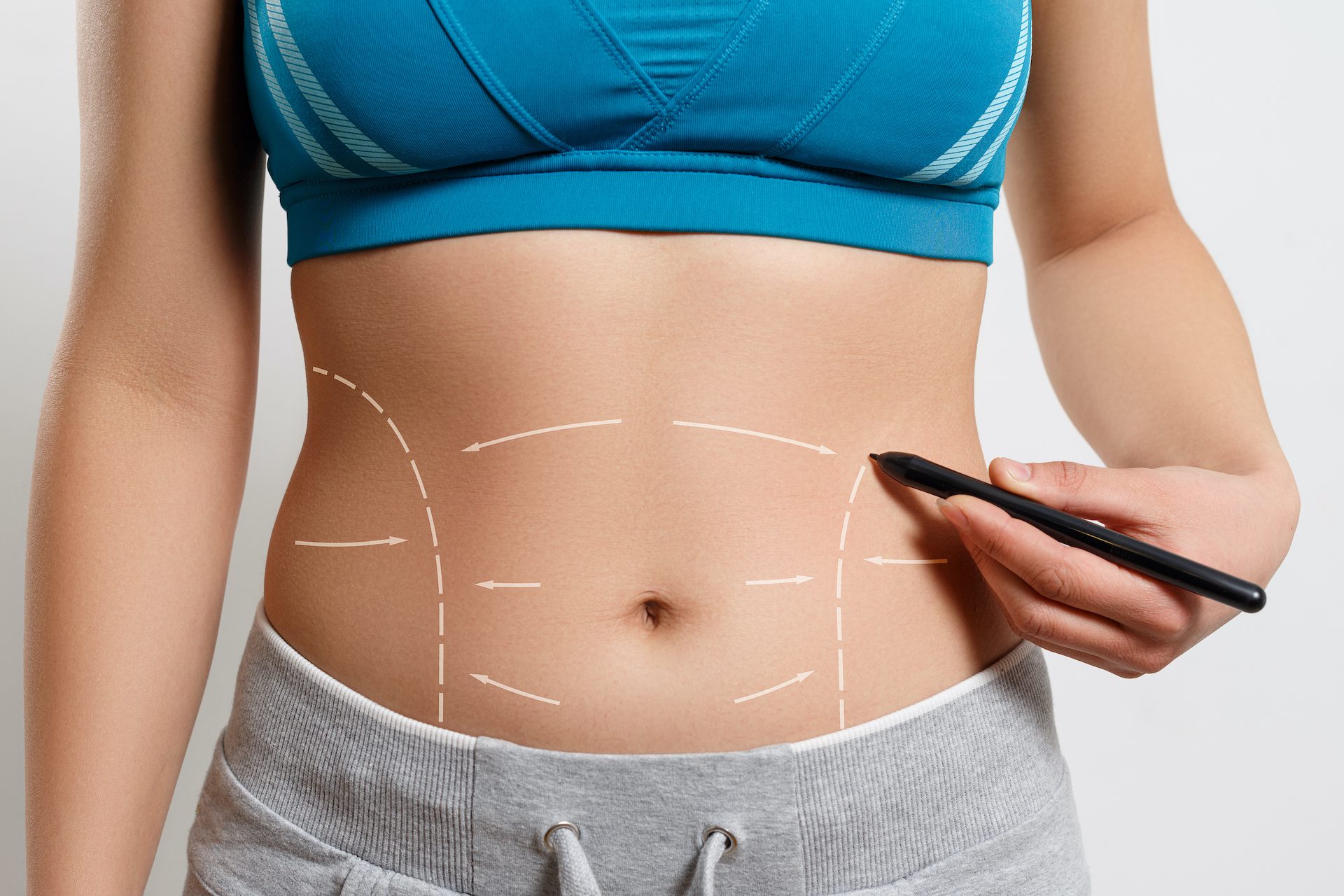 Before Liposuction: Understand the Real Cost