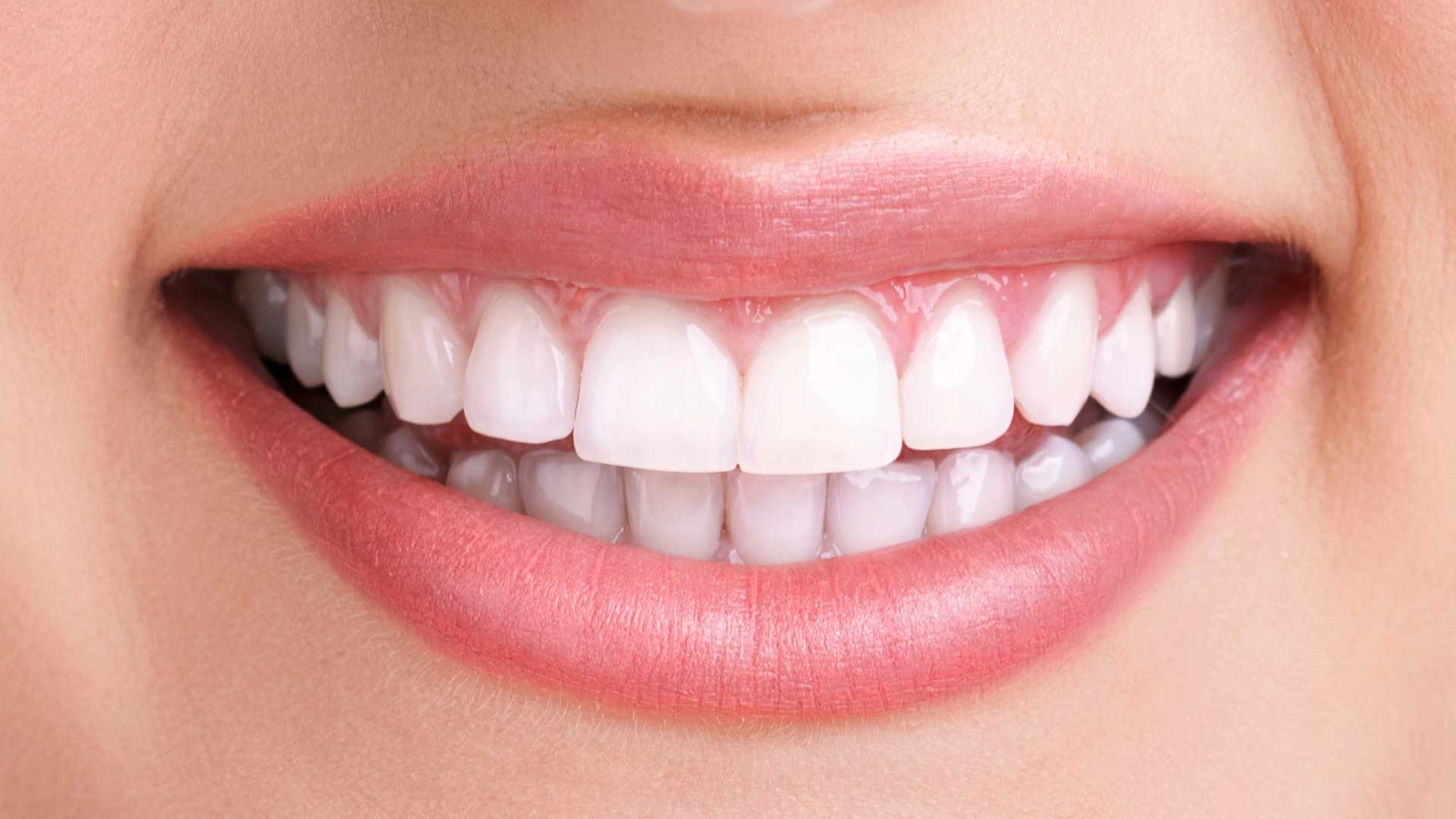 How to Predict Your Personal Teeth Whitening Cost
