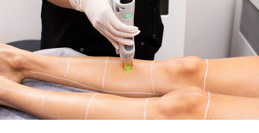 Laser Hair Removal Haram or Halal? What Scholars Really Say