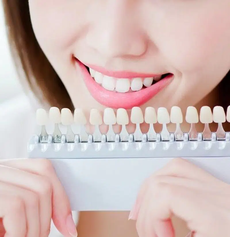Are Composite Veneers Safe for People With Sensitive Teeth?
