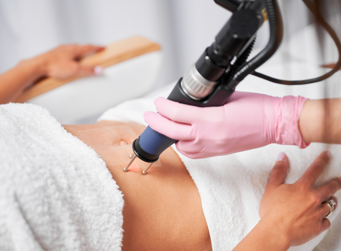 Reveal Flawless Skin Today with Scar Removal Dubai Experts
