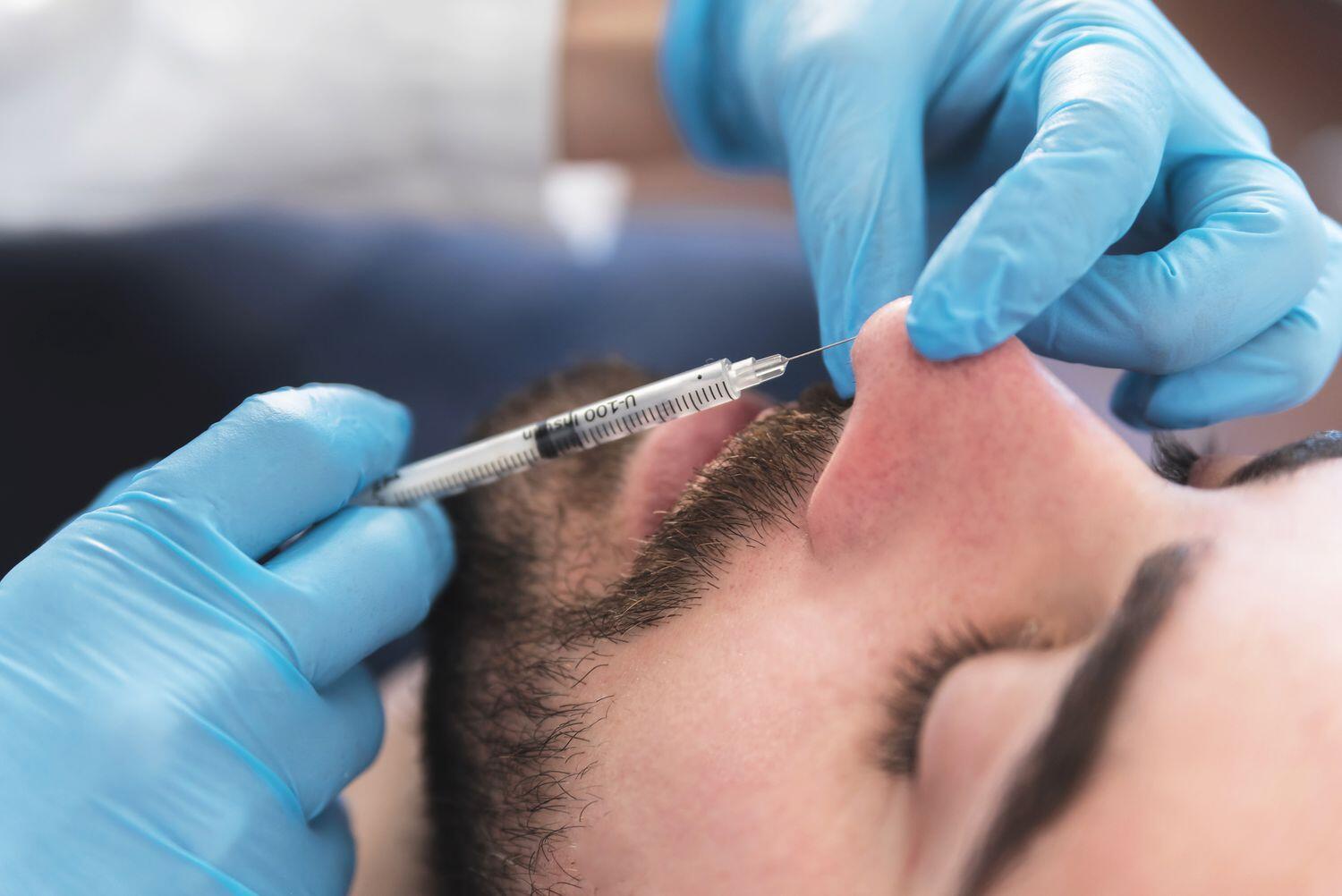 Achieve Sleek Nose Elegance Effortlessly With Hiko Nose Thread Lift