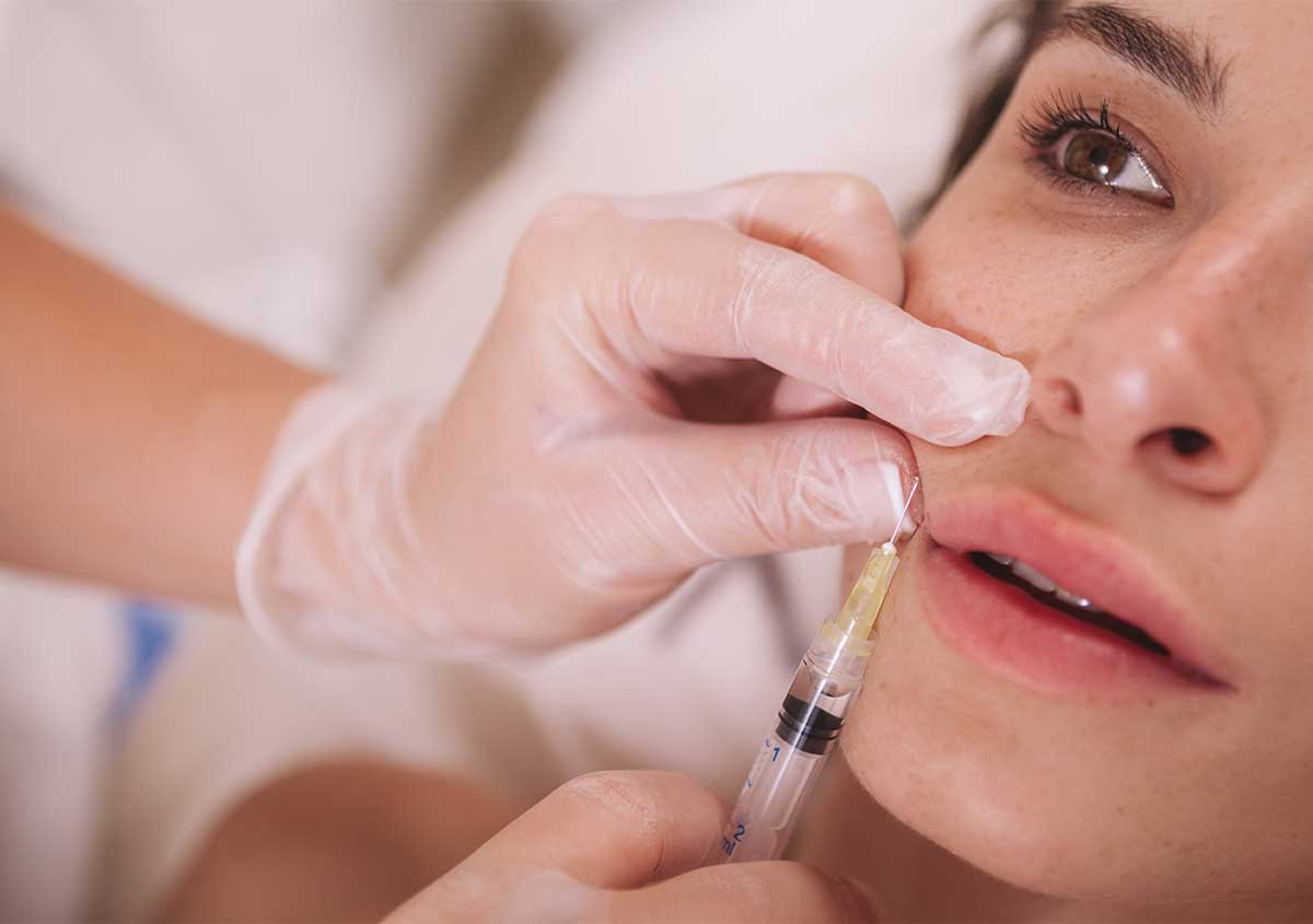Make Your Smile Shine Bright Today Using Russian Lip Fillers