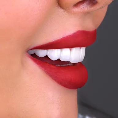 Brighten Your Look Fast with Natural-Looking Composite Veneers