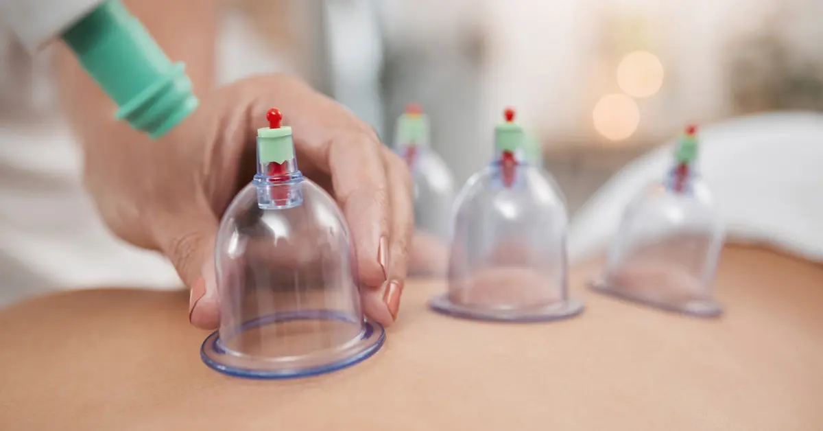 Unlock Deep Healing Benefits with Hijama Cupping Therapy Now