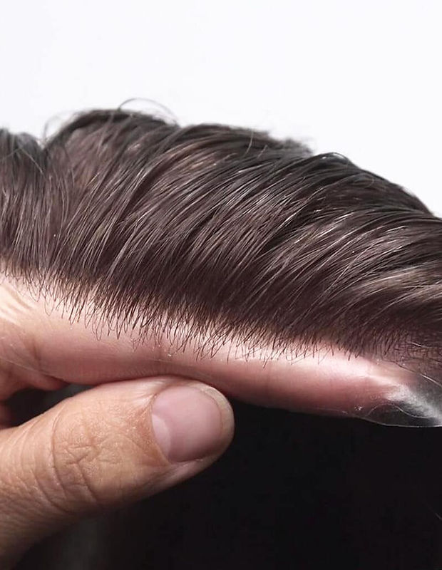 Hair Replacement Brings Back Confidence and Youthful Appearance