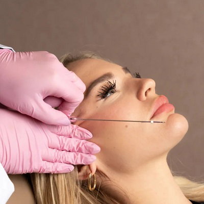 Reveal Your Youthful Glow Instantly with Thread Lift Treatment