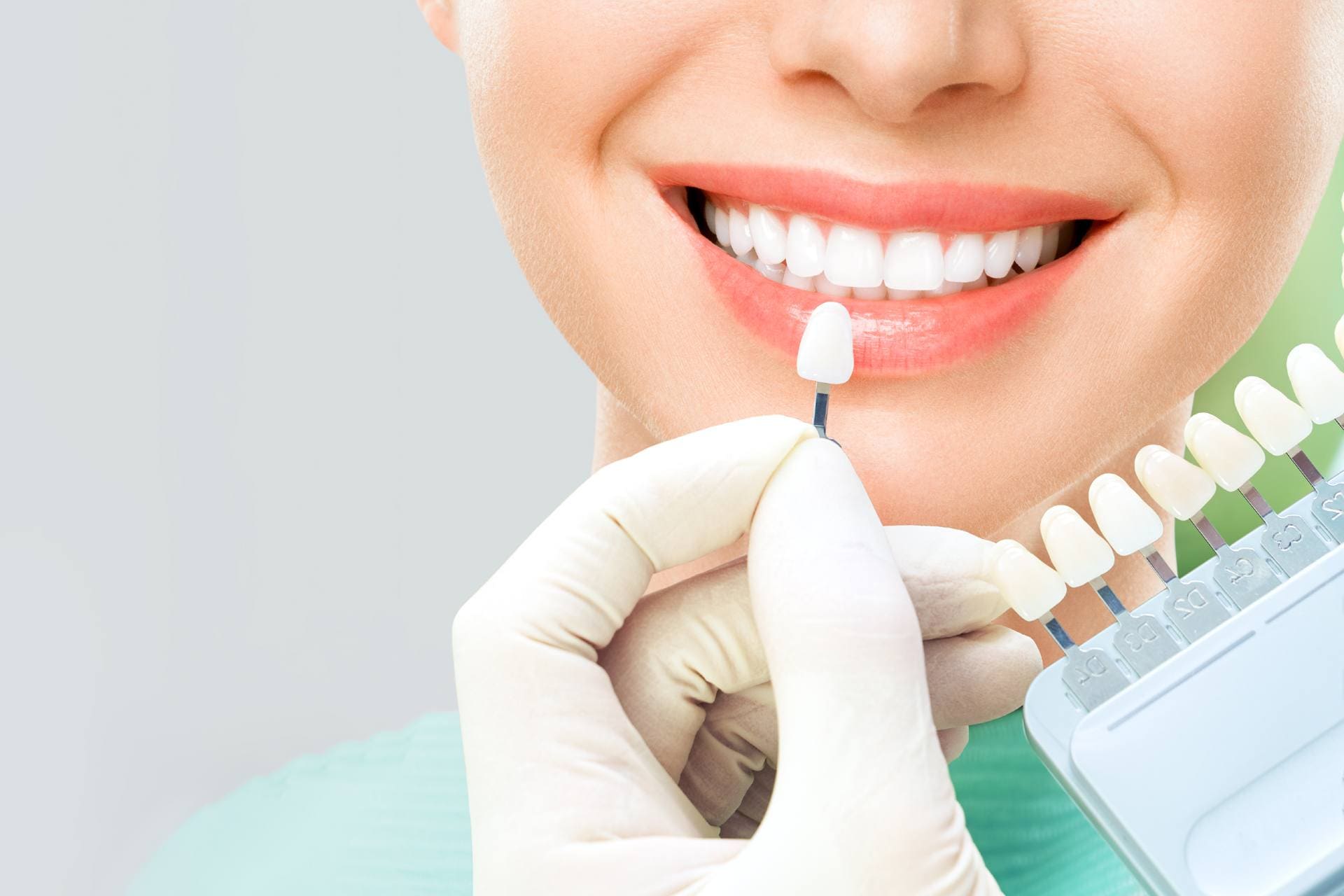Dental Veneers Cost Secrets That Instantly Upgrade Your Smile