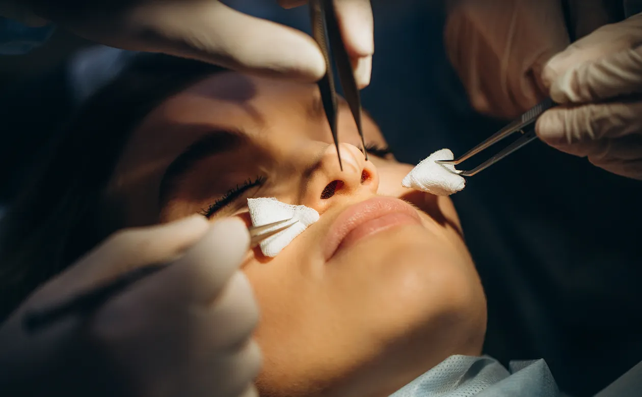 Striking Rhinoplasty Refined Redesign for Radiant New Energy