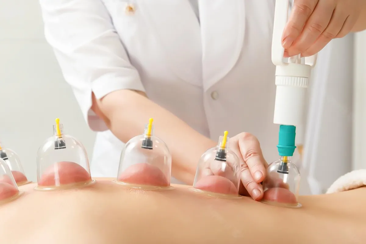 Hijama Cupping Therapy Radiance Boost for Holistic Strength Flow