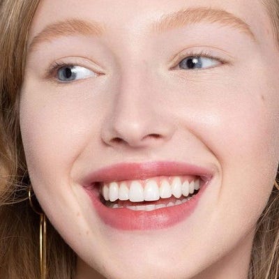 Revealing Brighter Smiles: Teeth Whitening in Dubai