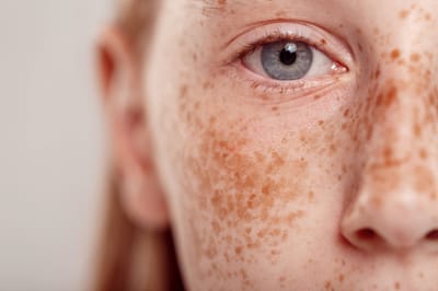 Pure Radiant Flow Freckles and Blemishes fade into smooth bright finish