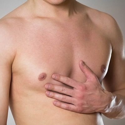 The Benefits of Gynecomastia Surgery for Men
