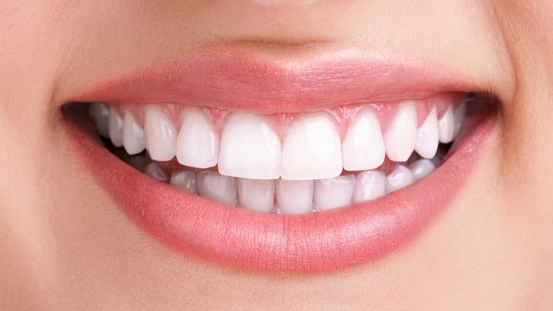 How to Predict Your Personal Teeth Whitening Cost