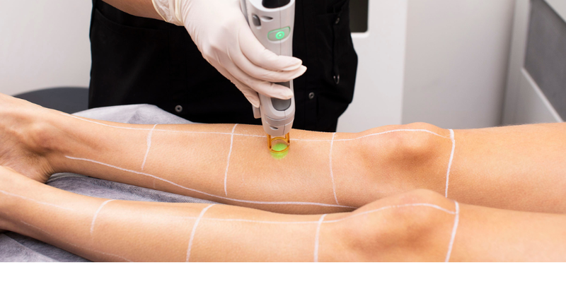 Laser Hair Removal Haram or Halal? Understanding Religious Views