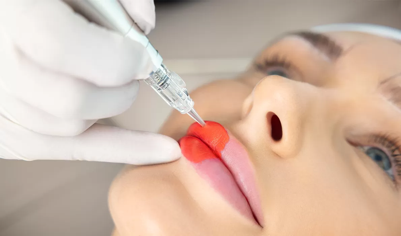 Fast Glow Secrets with Laser Treatment for Dark Lips