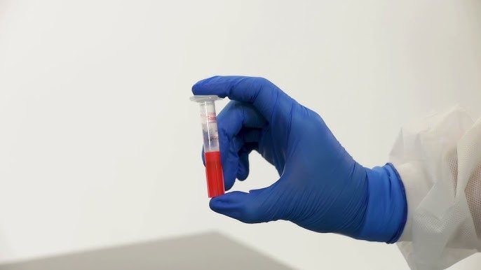 Take Health Control into Your Hands with Mycoplasma Test