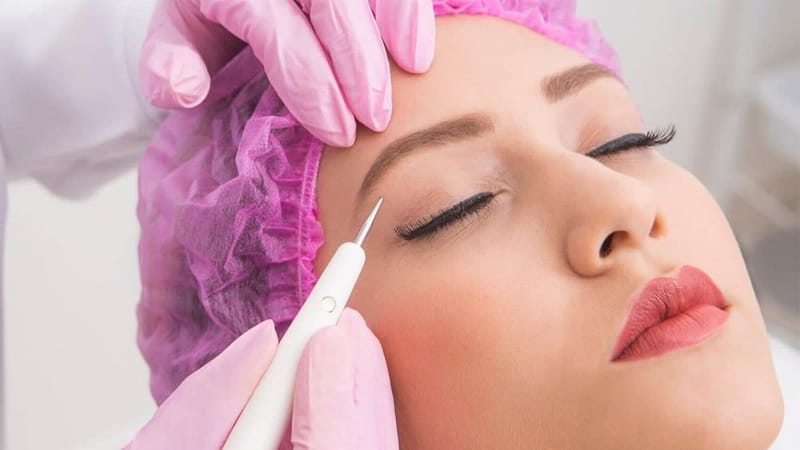 Plasma Pen Treatment Reduces Lines and Reveals Lasting Glow