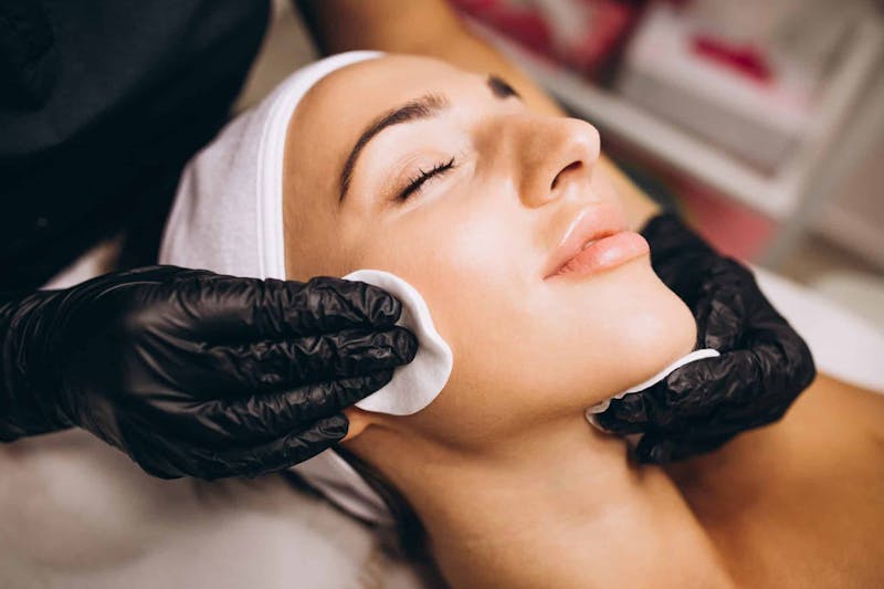 Elevate Your Skin Care Routine with Chemical Peel