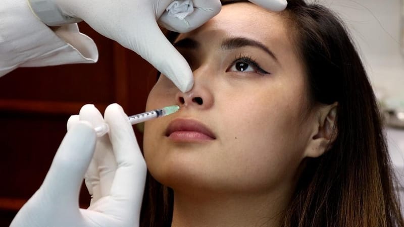 Unlock Nose Perfection With Hiko Nose Thread Lift Magic
