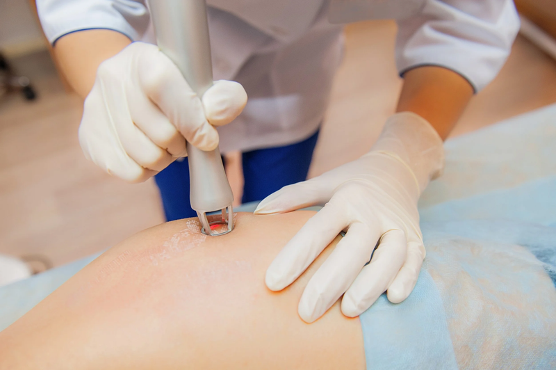 Scar Removal Dubai Helps You Radiate Confidence Every Day