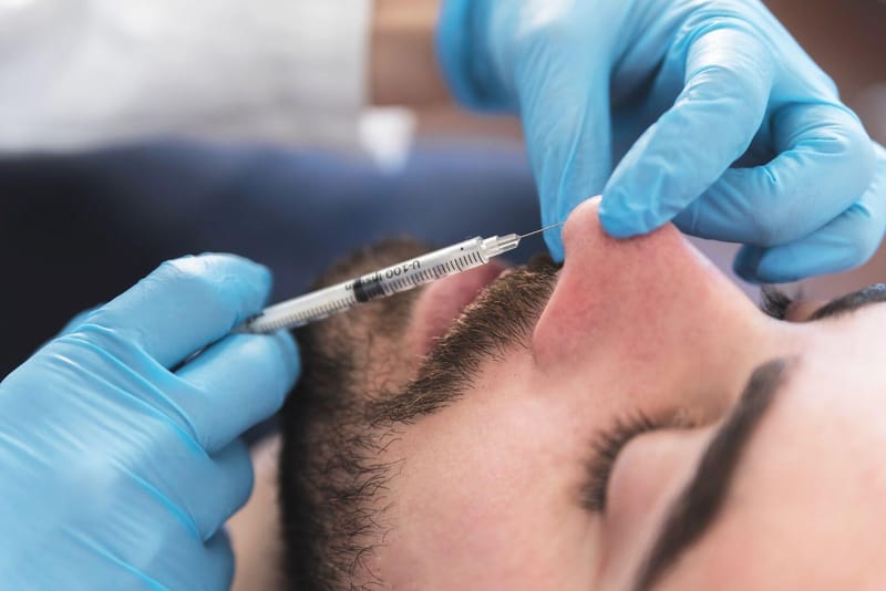 Achieve Sleek Nose Elegance Effortlessly With Hiko Nose Thread Lift