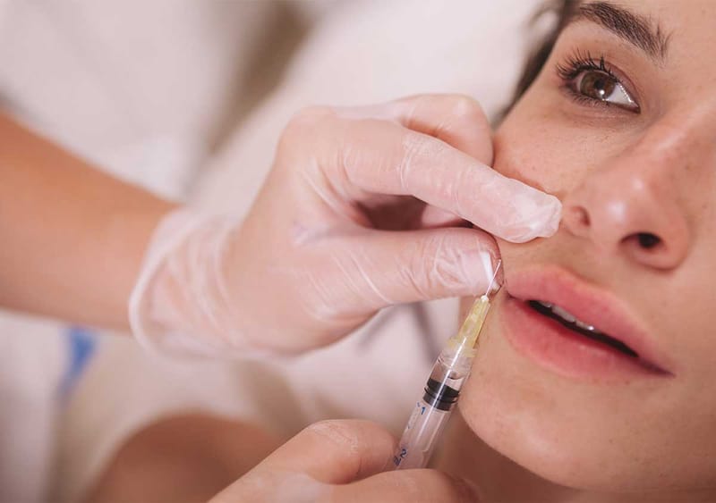 Make Your Smile Shine Bright Today Using Russian Lip Fillers