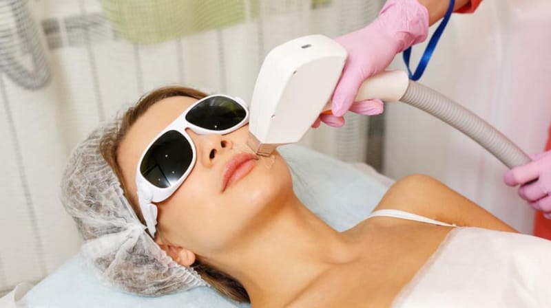 Achieve Smooth Radiant Lips Instantly with Laser Treatment for Dark Lips