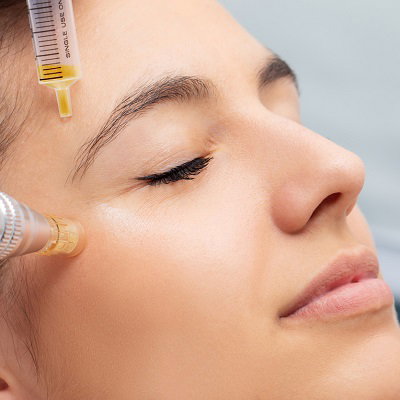 Plasma Pen Treatment for Smooth, Youthful, and Glowing Skin