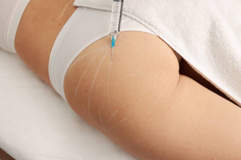 Transform Your Curves Instantly with Butt and Body Fillers Magic