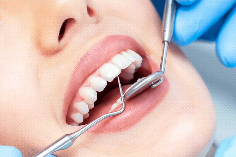 Dental Veneers Cost Secrets To Unlock Your Perfect Smile Instantly)