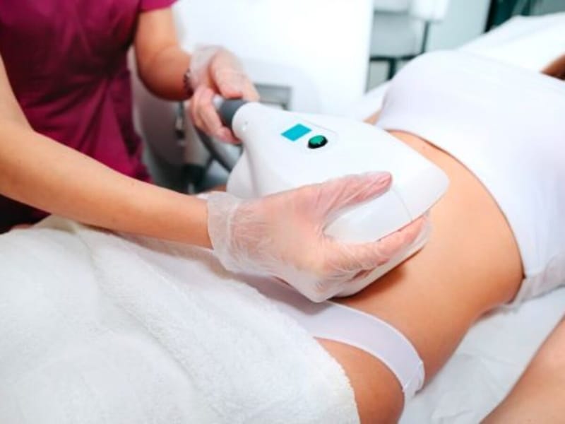 Step Into A New You With CoolSculpting Cost Smart Insights