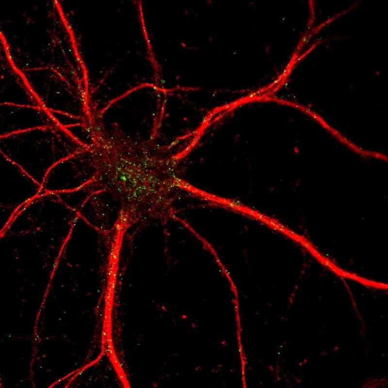 Mesenchymal Stem Cells -extracellular vesicles in neuronal cell survival