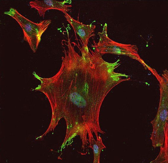 Extracellular transglutaminase-2 in tissue fibrosis: a new therapeutic avenue