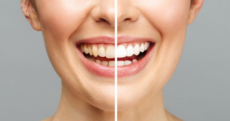 Teeth Cleaning for Diabetics: Key Insights