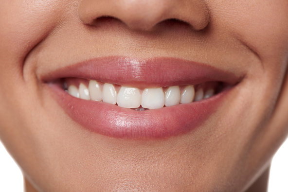 Is Teeth Whitening the Key to a Brighter, Healthier Smile?