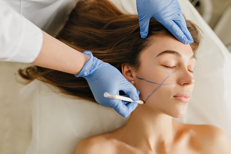 How Thread Lift Treatment Works for Fine-Tuning Features