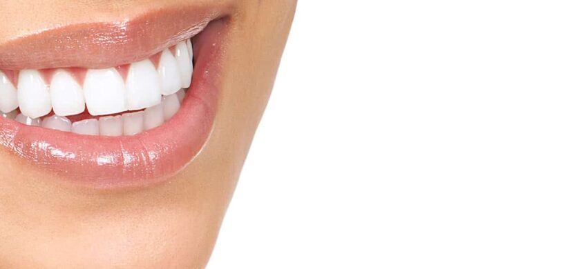 Is Teeth Whitening Effective for Tartar Stains?