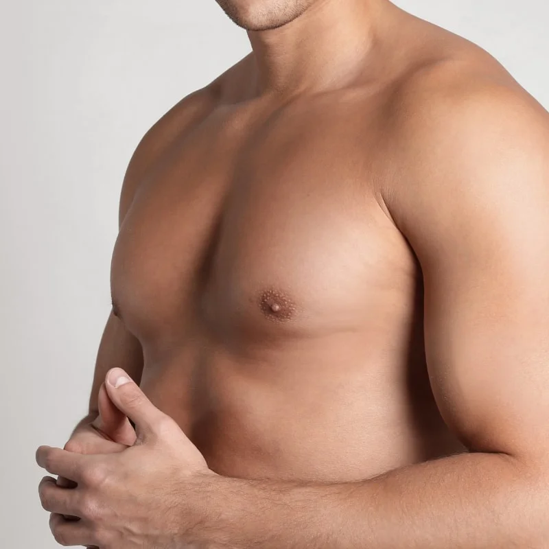 Is There a Non-Surgical Cure for Gynecomastia