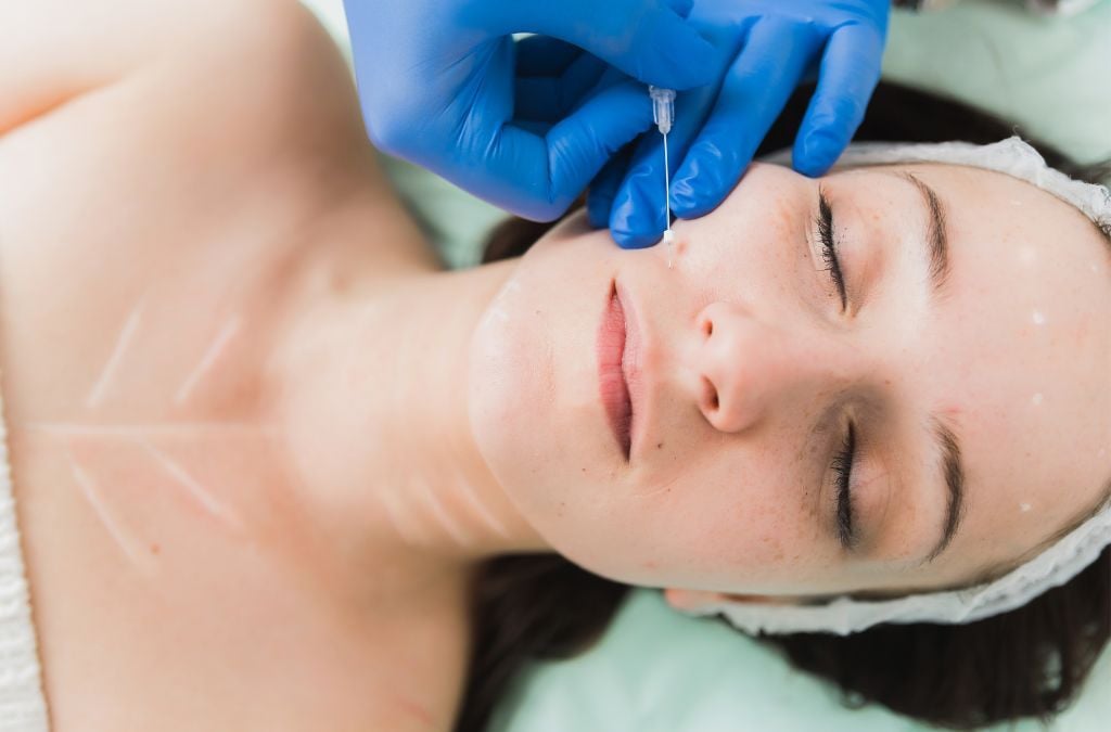 Instantly Lift and Tighten: The Wonders of Thread Lift Treatment
