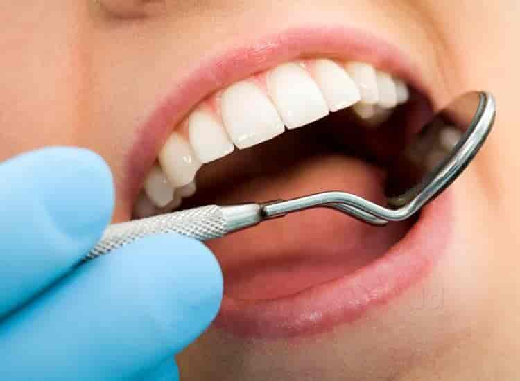 Can Teeth Cleaning Help Prevent Tooth Decay