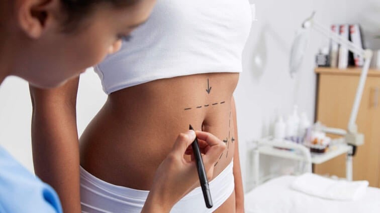 Are You a Good Candidate for a Tummy Tuck? Find Out