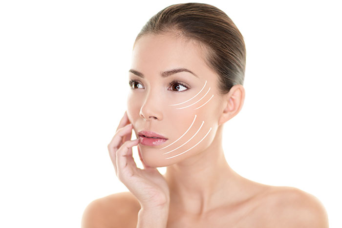 Thread Lift Triumph: The Non-Surgical Lift That Works Wonders