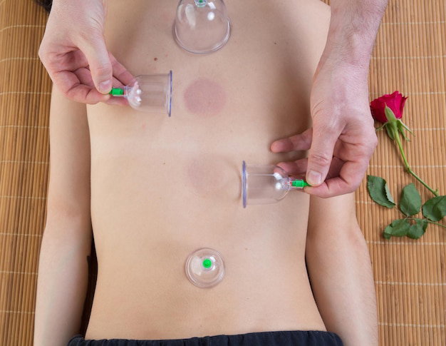 Specialized Hijama Treatment Techniques for Seniors