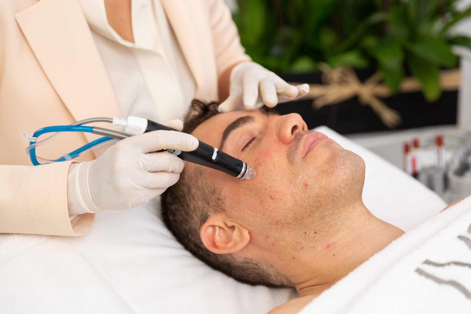 HydraFacial Aftercare: Step-by-Step Guide