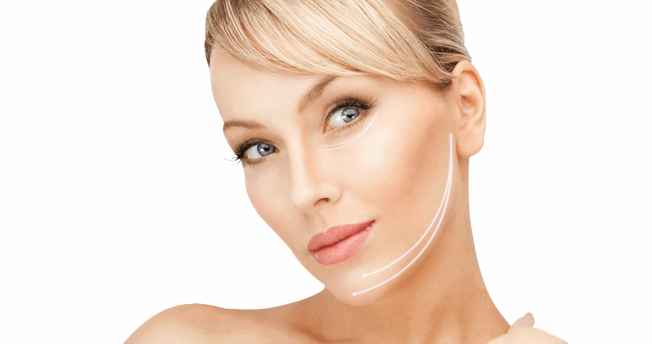 Maintaining Facelift Surgery Results Over Time