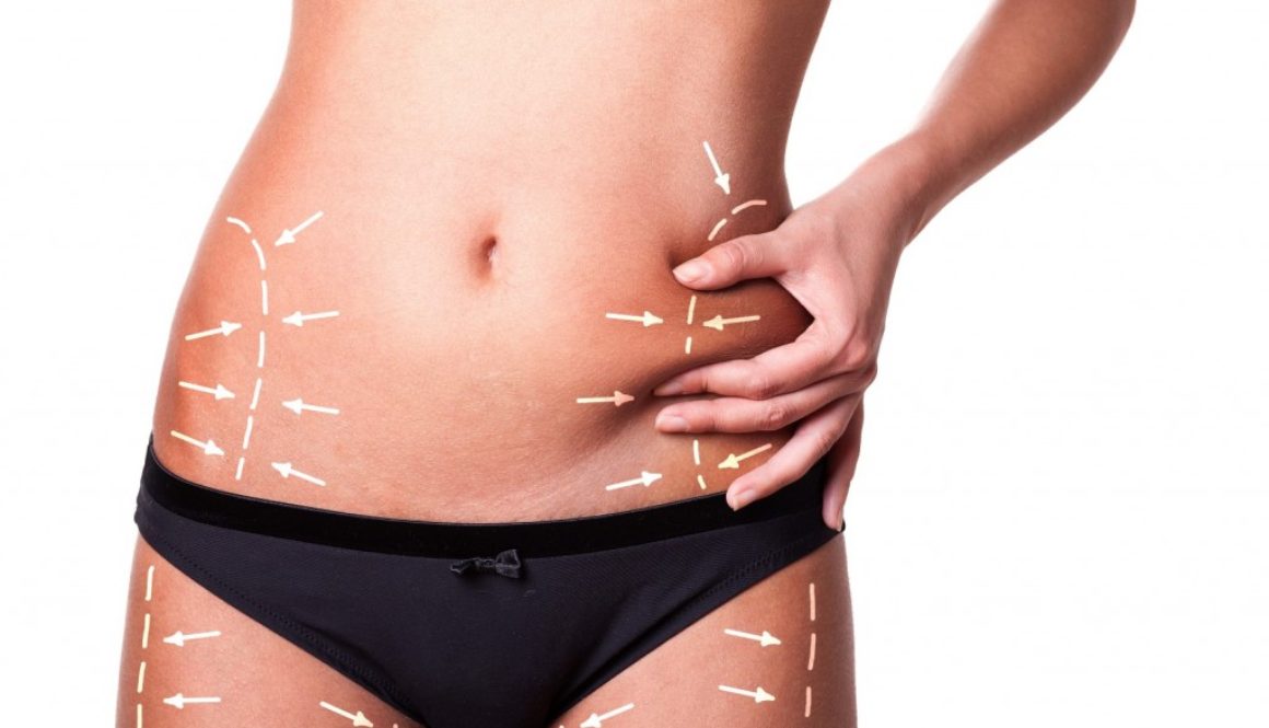 Top 5 Clinics for Liposuction in Dubai