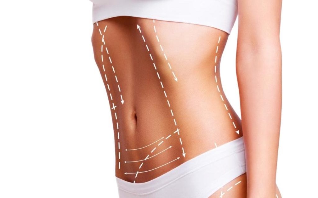 How Does Enfield Royal Clinic Compare for Laser Liposuction?