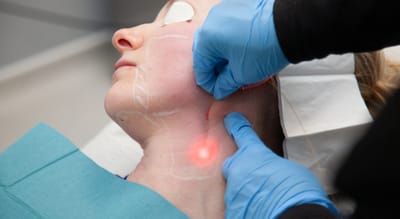 How Endolift Helps Achieve a Lifted and Toned Appearance